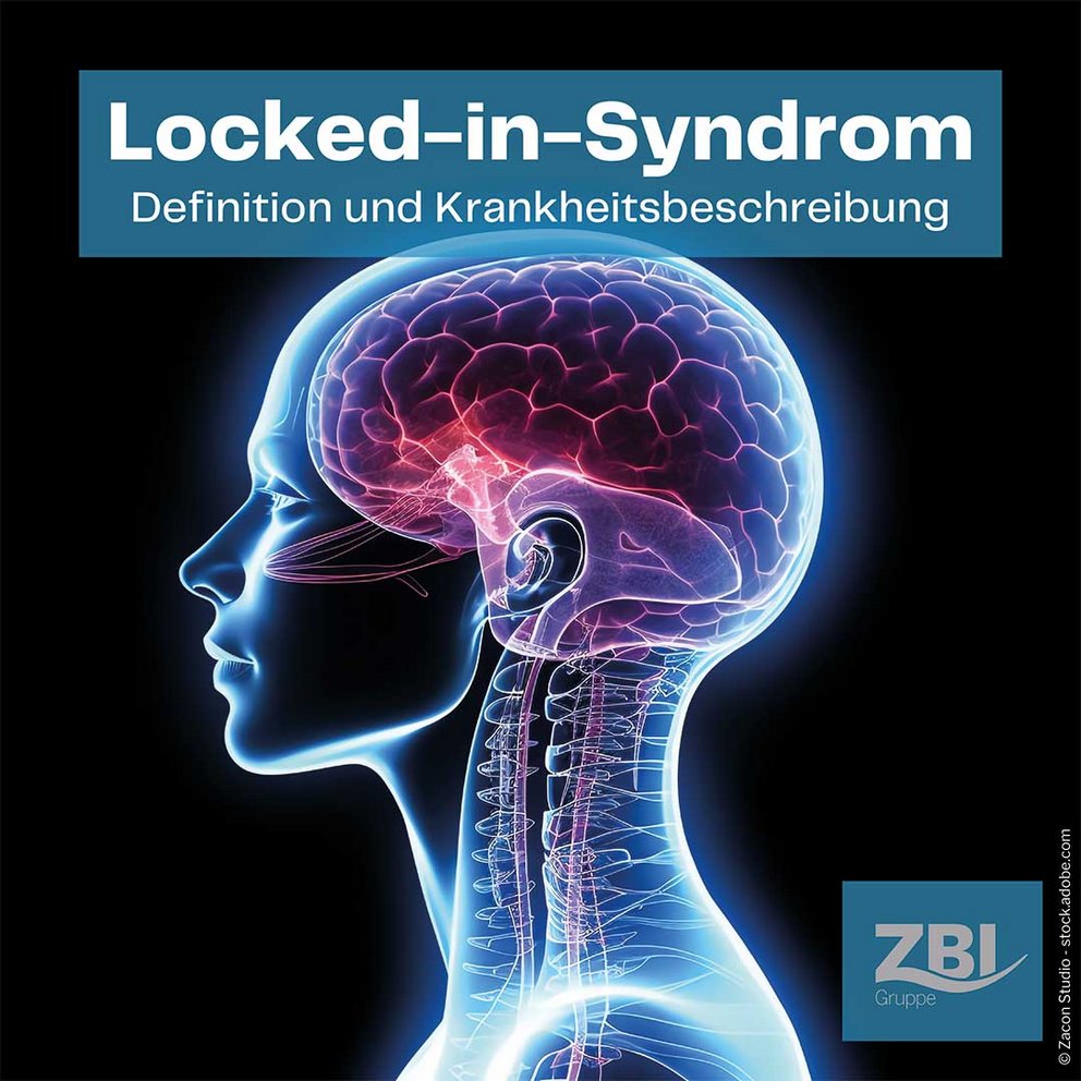 Titelbild des Blogartikels mit einer grafischen Darstellung der Seitenansicht des Kopfes eines Menschen mit Gehirn und Skelett sowie eingeblendeter Titel Locked-in-Syndrom