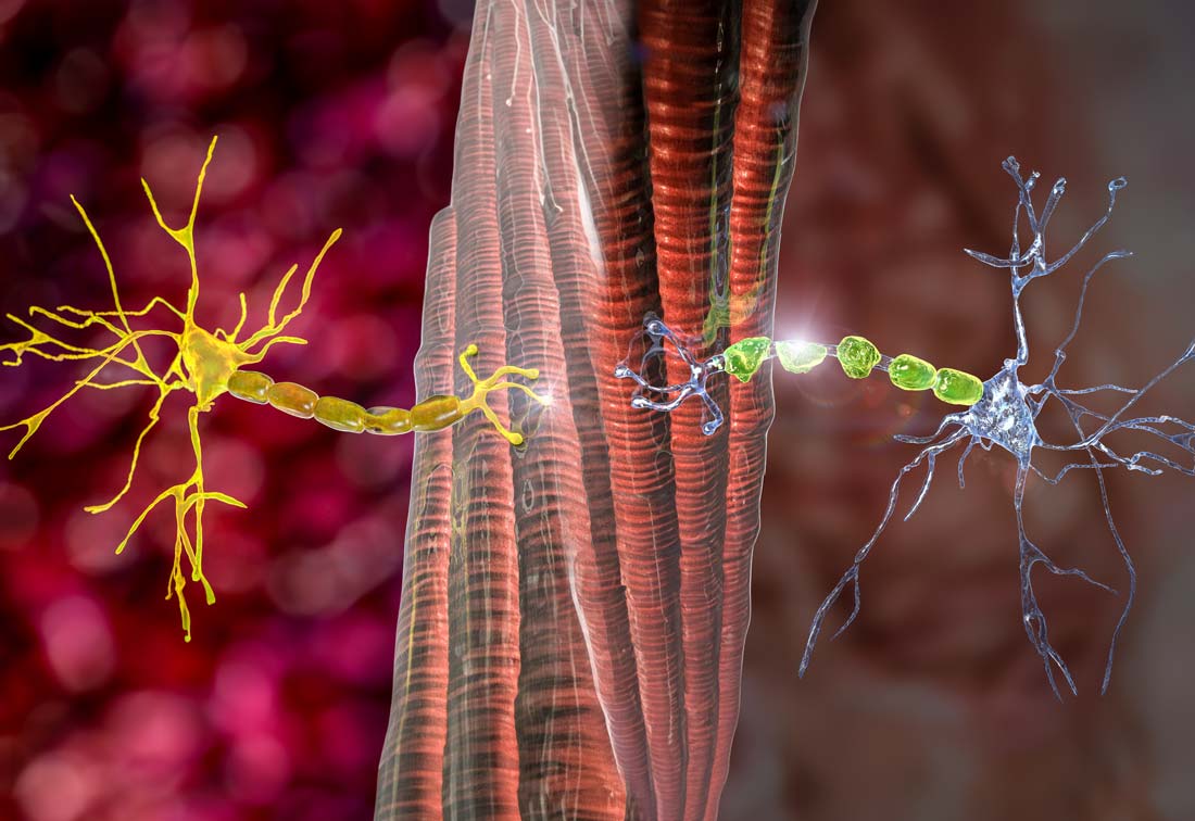 Eine intakte Nervenzelle, links, im Vergleich zu einer beschädigten Nervenzelle, rechts.