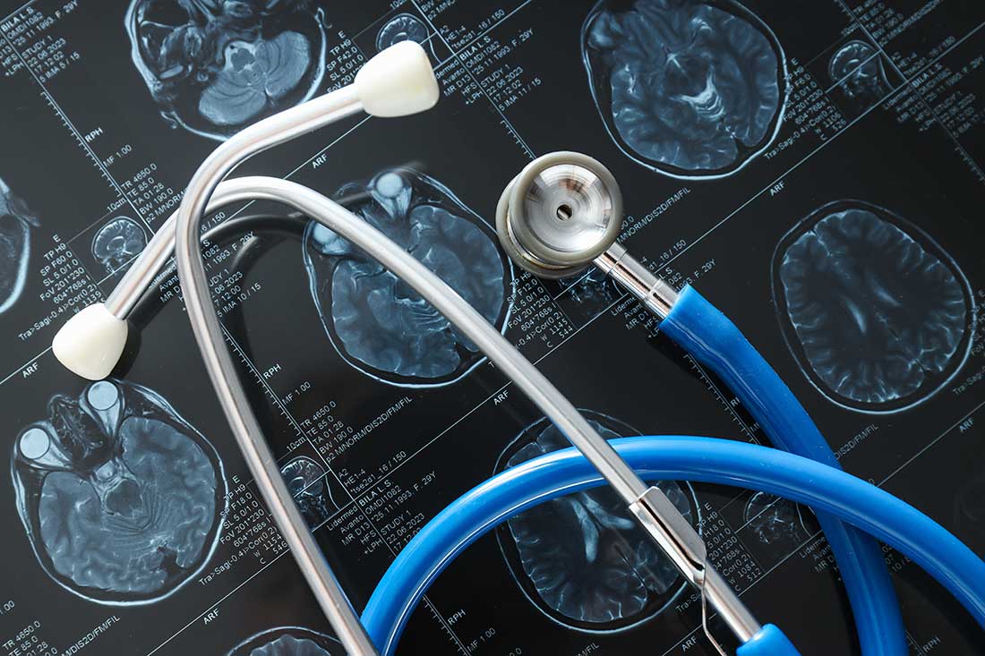 MRT oder Magnetresonanztomographie des Kopfes und Gehirns mit einem Stethoskop in. Einer Nahaufnahme