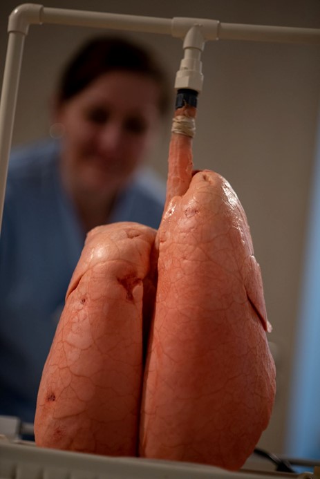 Ansicht einer präparierten Lunge: Bei einer Lungenfibrose ist das Lungengewebe geschädigt und vernarbt.