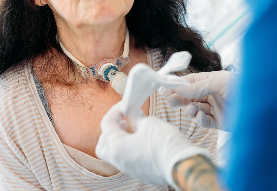 Eine Pflegefachkraft hält eine Kompresse vor einer Patientin mit einem Tracheostoma